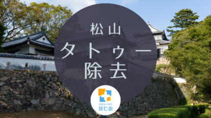 松山　タトゥー除去　安い